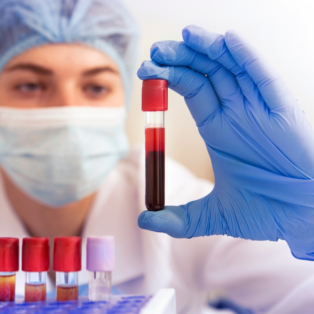 Hormone Assay